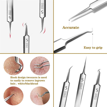 Acne Blackhead Removal Tweezers